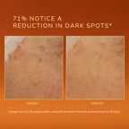 Radiance Serum: Jume kirgastav ja pigmendilaike vähendav seerum