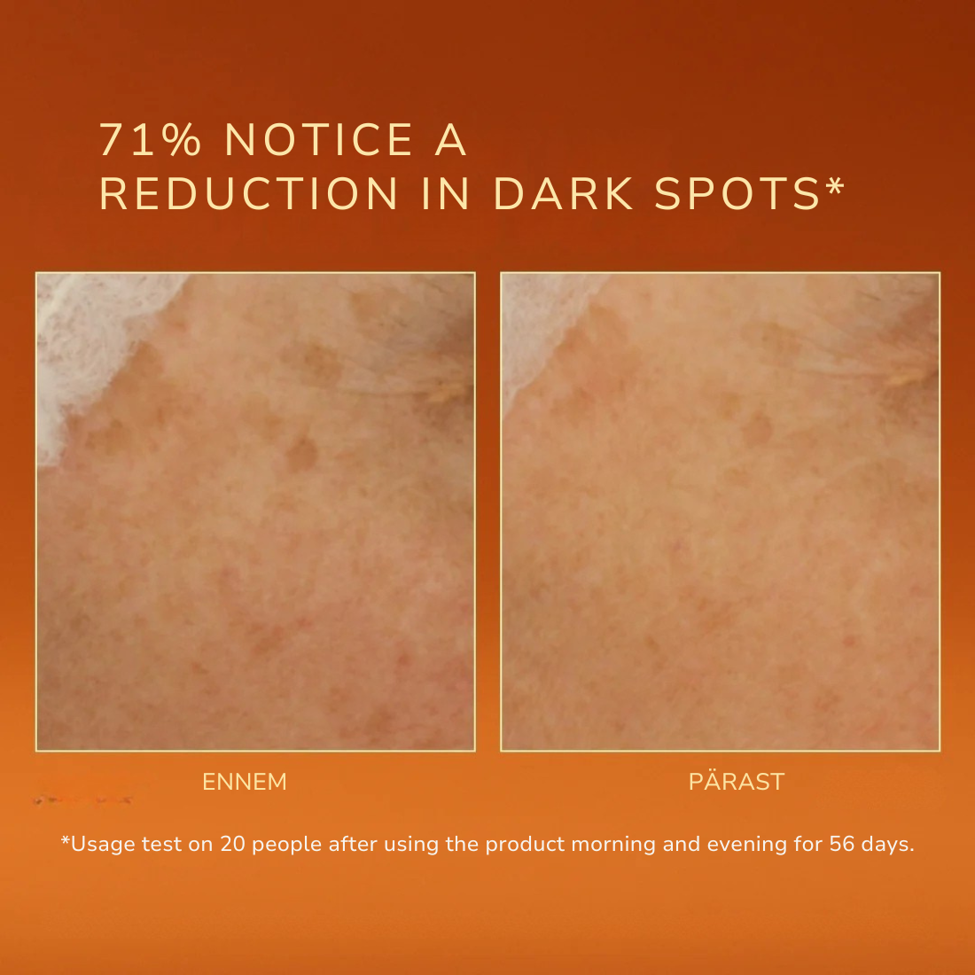 Radiance Serum: Jume kirgastav ja pigmendilaike vähendav seerum