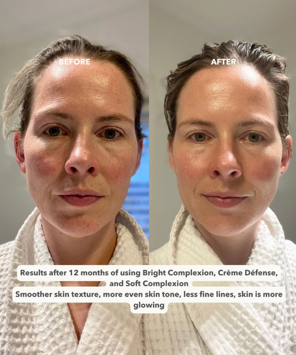 BRIGHT COMPLEXION™ - Ultra Rich Radiance Serum