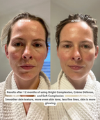 BRIGHT COMPLEXION™ - Ultra Rich Radiance Serum