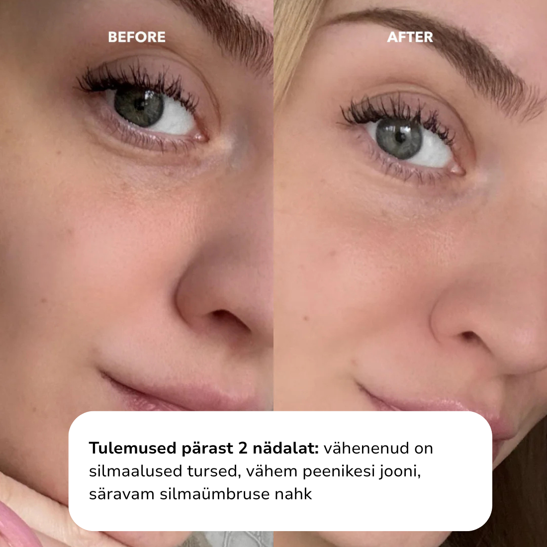 EYE LIFT™ - Firming and Smoothing Eye Cream