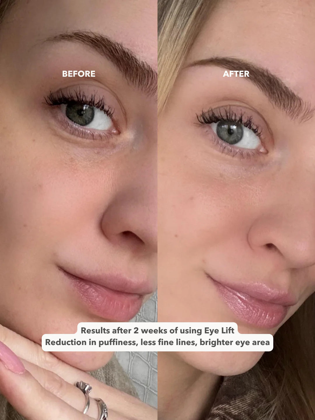 EYE LIFT™ - Firming and Smoothing Eye Cream