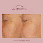 Before-and-after comparison of skin texture on a woman's cheek, showing a 20% improvement with Estonian text on a dusty pink background.